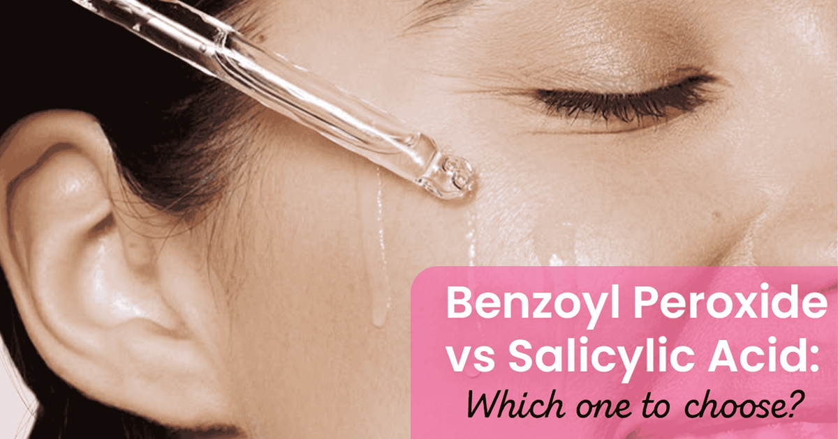 Benzoyl Peroxide vs. Salicylic Acid: Which is Better for Skin?