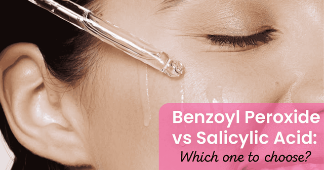 Benzoyl Peroxide vs. Salicylic Acid: Which is Better for Skin?
