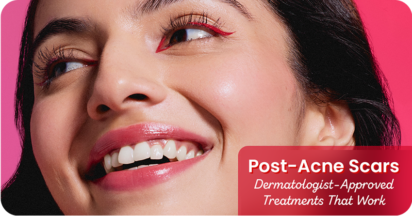 Post-Acne Scars: Dermatologist-Approved Treatments That Work