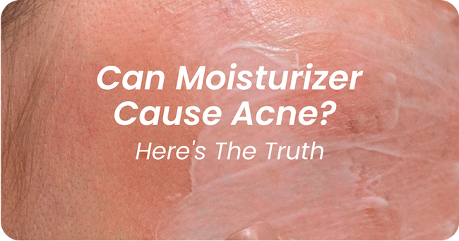 Can Moisturizer Cause Acne? The Truth About Breakout