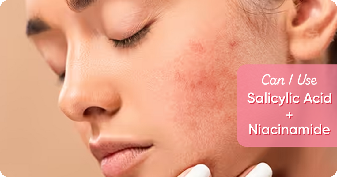 Can You Use Salicylic Acid and Niacinamide Together?
