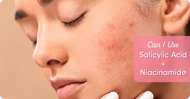 Can You Use Salicylic Acid and Niacinamide Together?