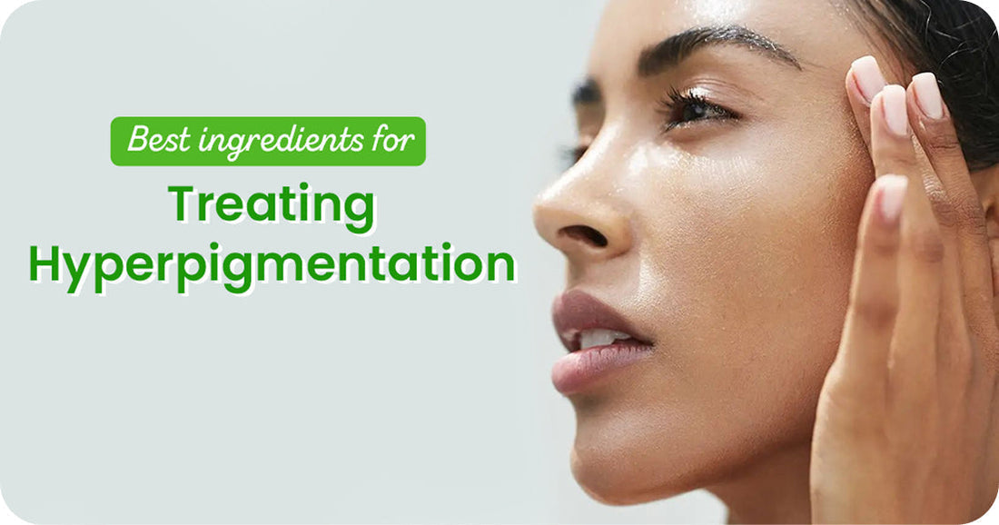 The Best Ingredients for Treating Post-Inflammatory Hyperpigmentation