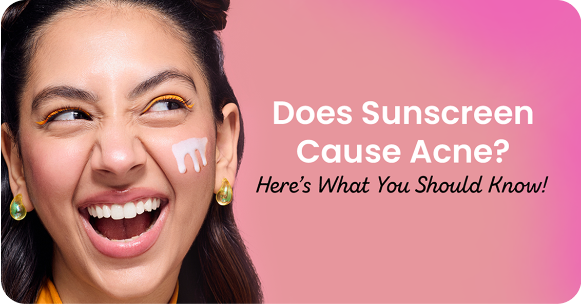 Does Sunscreen Cause Acne? Here’s What You Should Know!
