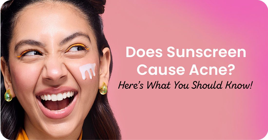 Does Sunscreen Cause Acne? Here’s What You Should Know!
