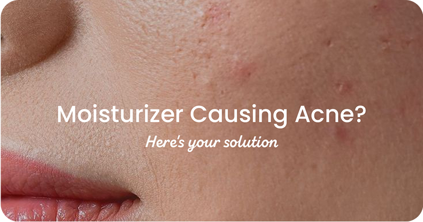 Is Your Moisturizer Breaking You Out? Signs and Solutions
