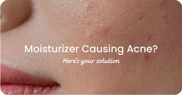 Is Your Moisturizer Breaking You Out? Signs and Solutions