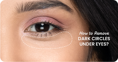 How to Remove Dark Circles Under Eyes Permanently?