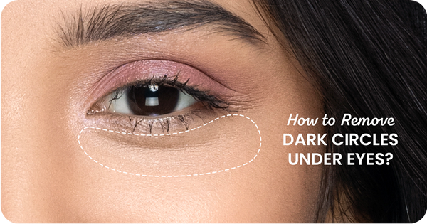 How to Remove Dark Circles Under Eyes Permanently?