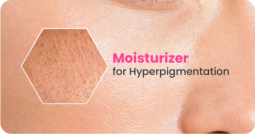 Can Moisturizers Help with Hyperpigmentation?
