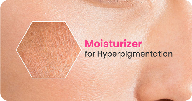 Can Moisturizers Help with Hyperpigmentation?