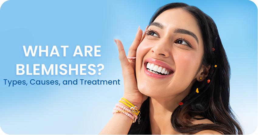 What Are Blemishes? Types, Causes, and Treatment
