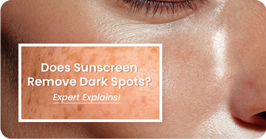 Does Sunscreen Remove Dark Spots? Expert Explains!