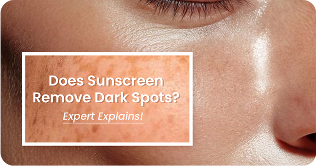 Does Sunscreen Remove Dark Spots? Expert Explains!