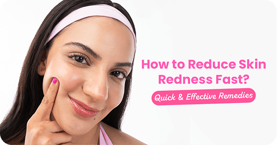 How to Reduce Skin Redness Fast? Quick & Effective Remedies