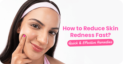 How to Reduce Skin Redness Fast? Quick & Effective Remedies