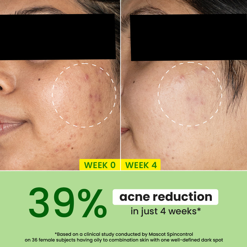 Cica Calming Night Gel (Niacinamide + Green Tea)