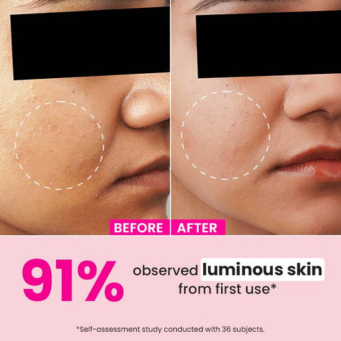 Watermelon & 10% Glycolic Serum