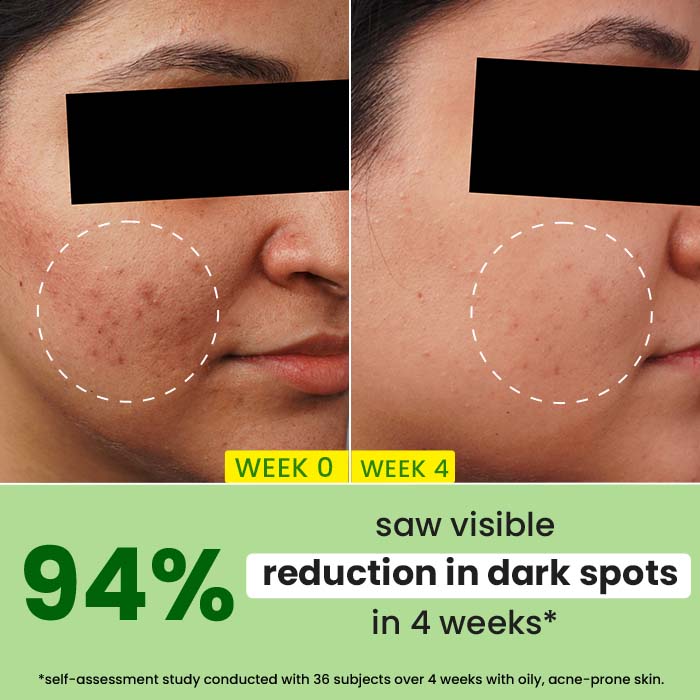 Cica + 10% Niacinamide Face Serum for Oily Skin