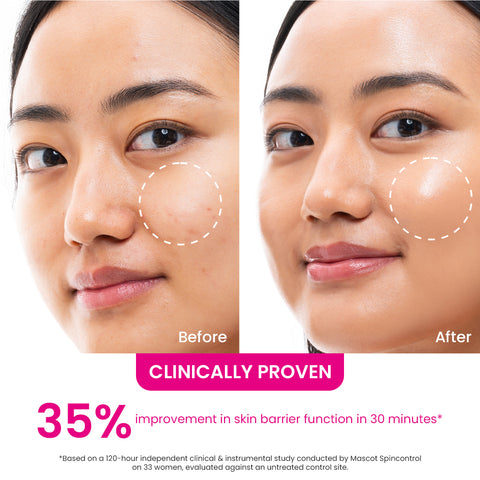 Dragon Fruit Bounce Jelly Moisturizer With Plant PDRN