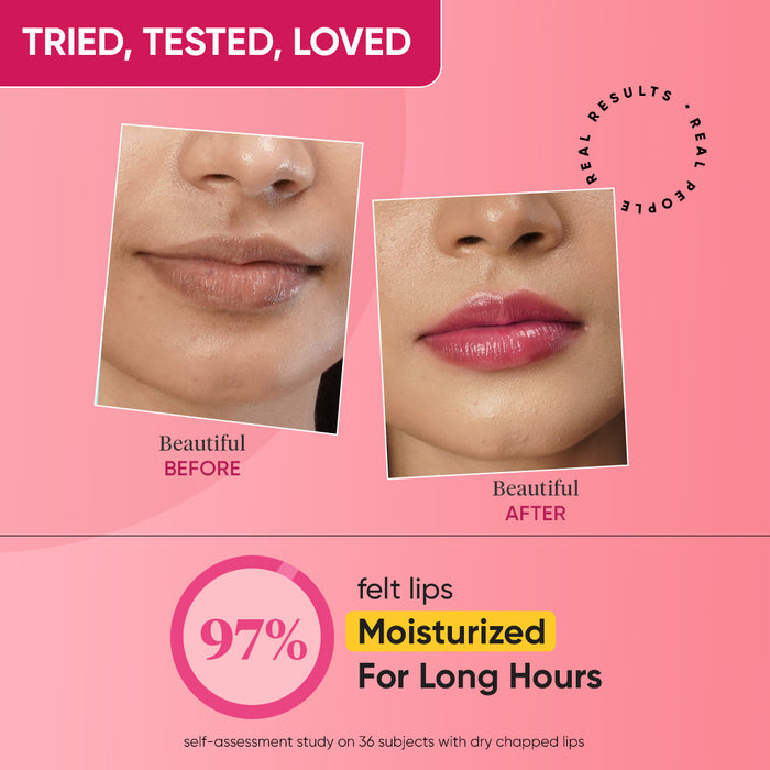 Vitamin C + E Gloss Boss Lip Balm In-Vivo Tested SPF 50+ PA+++ Vitamin C + E Gloss Boss Lip Balm In-Vivo Tested SPF 50+ PA+++