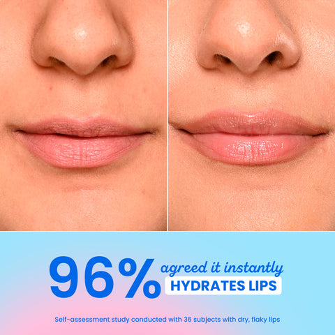Barrier Repair Hydrating Lip Balm In-Vivo Tested SPF 50+ PA+++