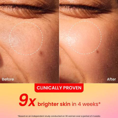 Vitamin C + E Super Bright Gel Moisturizer for Face