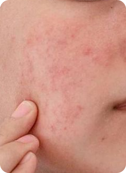 Face Serums Causing Breakouts? Here’s Why and How to Fix It