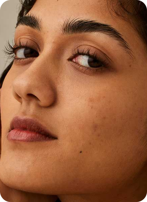 Hyperpigmentation vs. Dark Spots: What’s the Difference?