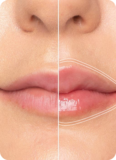 What is Lip Plumper and How to Use it? A Guide to Fuller Lips