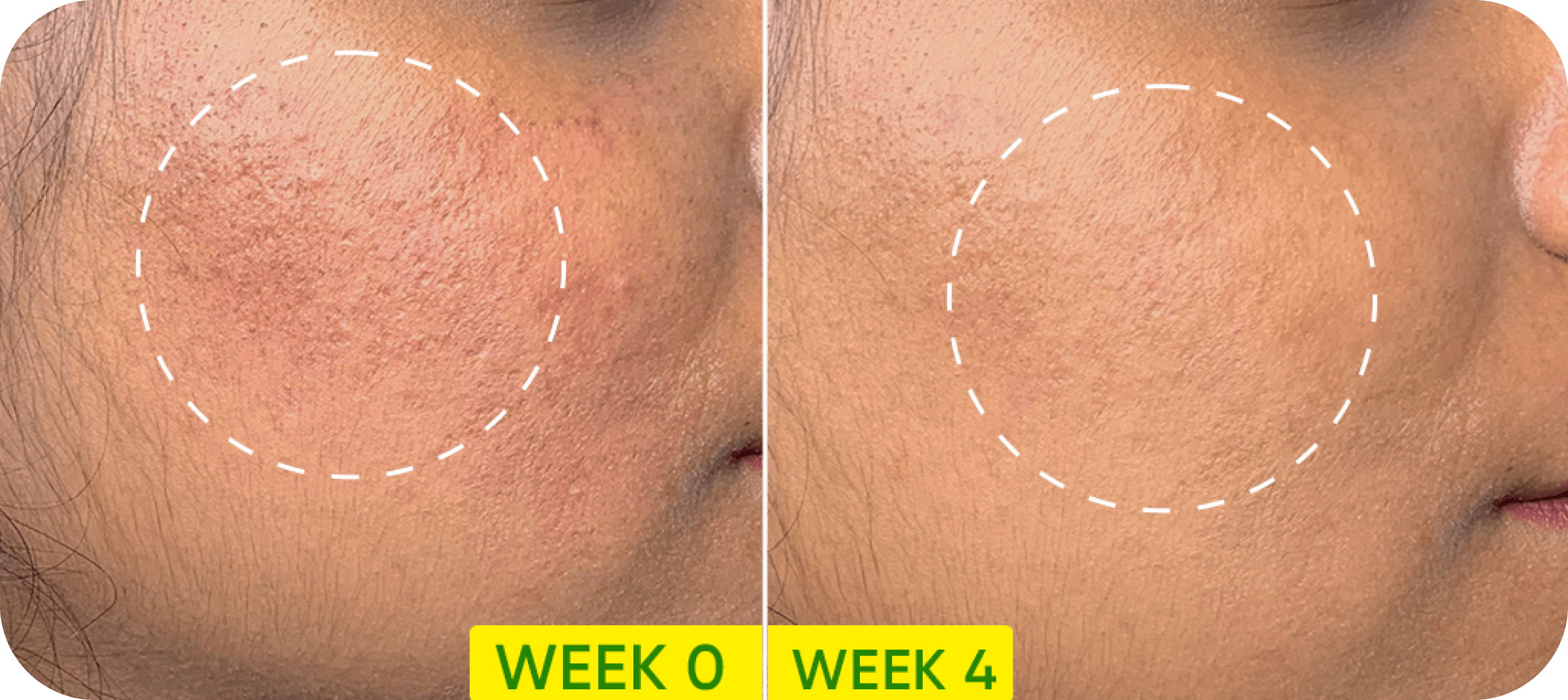 Cica + Niacinamide Oil-Free Gel Moisturizer For Face