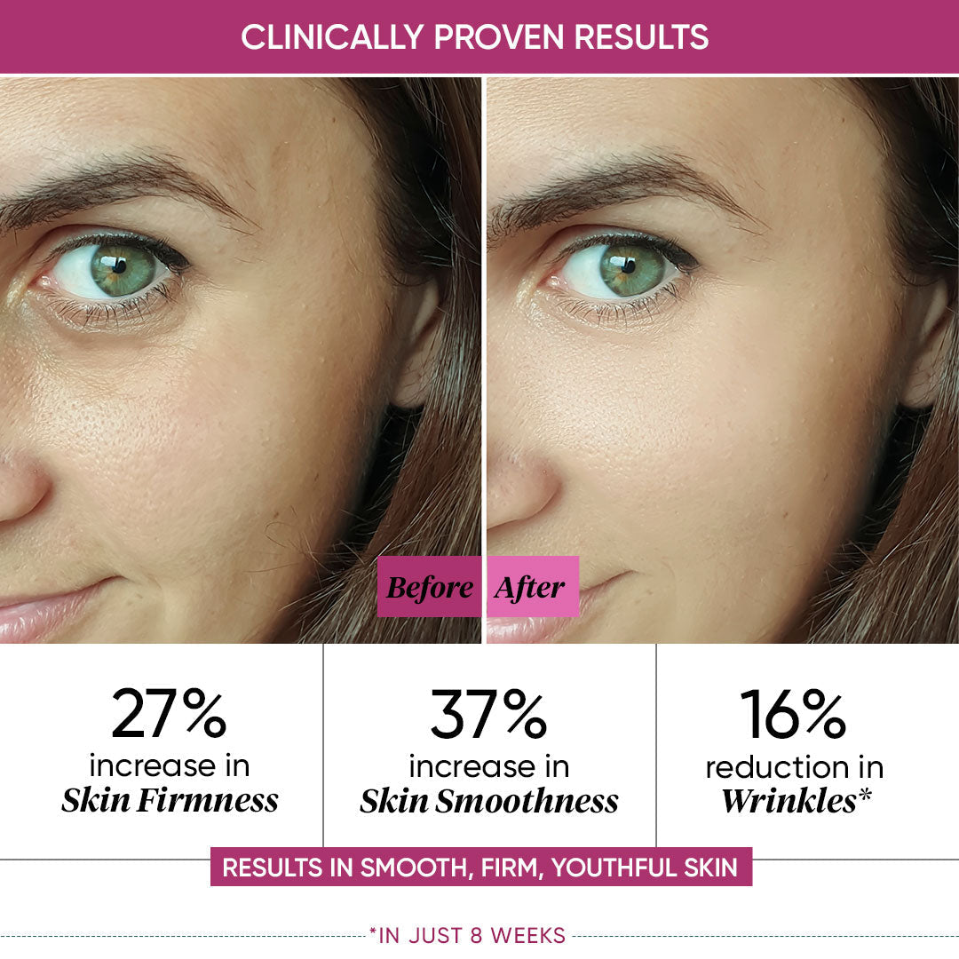 

Night Reset Retinol Cream| Anti-ageing night cream | Dot & Key